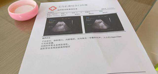 苏州代孕产子套餐，南京第三代试管代孕儿童医院排名？试管婴儿-ET机构列表？