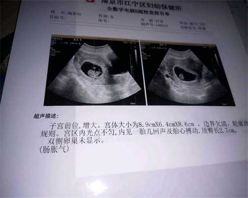 上海代生孩子_想找个代孕机构_这5类女性不孕风