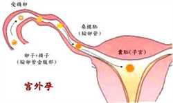 南京供卵代怀哪里靠谱，南京第三代试管婴儿技术