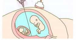 南京供卵助孕案例，南京试管婴儿医院排名？附南京试管成功率费用明细？