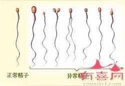 南京供卵代孕和试管，江苏代孕龙凤胎案背景