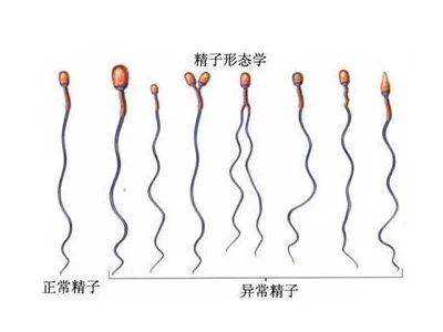 南京供卵助孕哪里便宜，南京供卵试管婴儿的价格